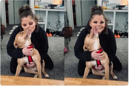 Kinh hoàng người phụ nữ bị chó pitbull cắn đứt lìa mũi