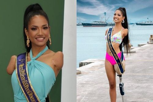 Câu chuyện cảm động về mỹ nữ khuyết tật và hành trình gian nan đến với Miss Universe