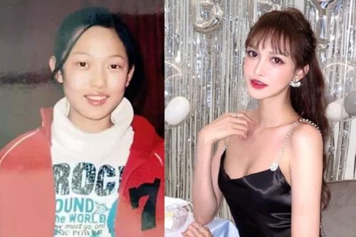 Trung Quốc siết quảng cáo phẫu thuật thẩm mỹ