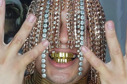 Mối nguy hiểm của sở thích cấy xích vàng vào da đầu
