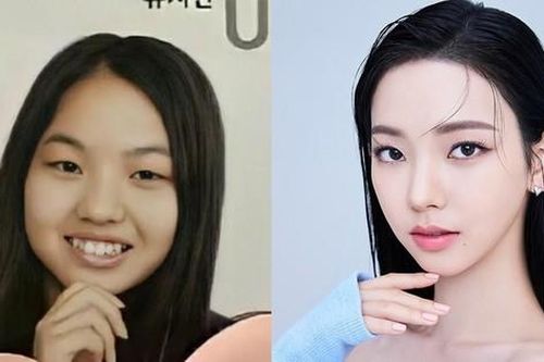 Karina (aespa) lộ ảnh quá khứ khác lạ khiến nghi vấn đụng dao kéo bùng nổ trở lại