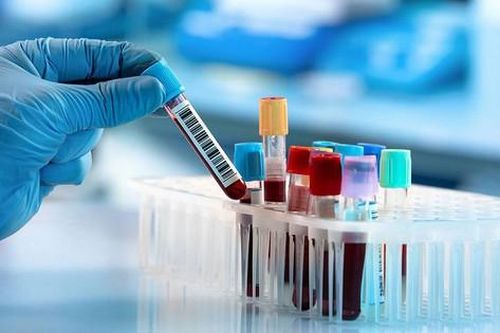 Xét nghiệm máu phát hiện sớm ung thư