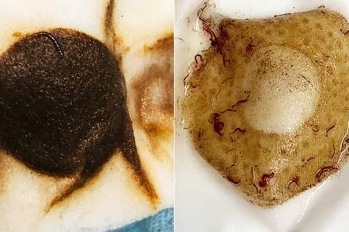 Hà Nội: Hãi hùng cảnh giun sán dày đặc trong nước sinh hoạt của người dân