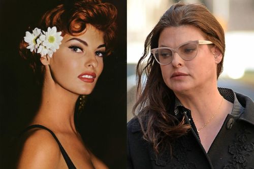 Siêu mẫu Linda Evangelista bị biến dạng cơ thể vì làm đẹp
