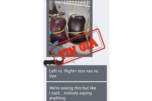 Thông tin 'nhận biết người tiêm vaccine Covid-19 thông qua sắc thái màu của máu' là tin giả