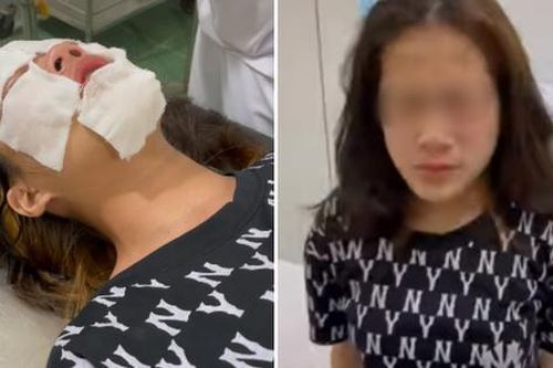 Hải Phòng: Chọc ghẹo không thành, nam thanh niên cay cú hành hung, xịt hơi cay vào mặt nữ sinh rồi bỏ đi