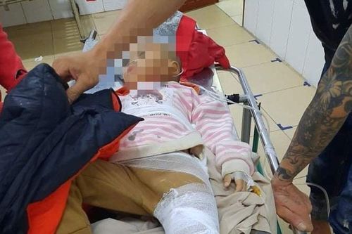 Sạt lở núi làm sập nhà dân, 1 cháu nhỏ bị gãy xương cổ đùi