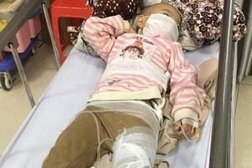 Sạt lở đất trong đêm, 2 cháu nhỏ bị thương phải nhập viện