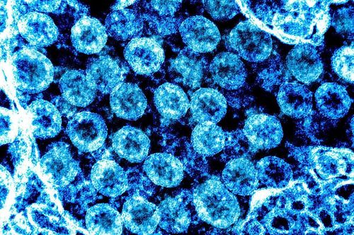 Phát hiện virus mới giống nCoV