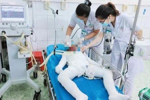 Nghi án bố tẩm xăng thiêu 3 con nhỏ rồi tự tử