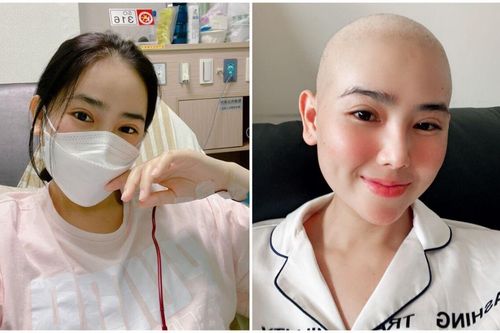 Cô gái xinh đẹp phát hiện ung thư ở tuổi 28 sau chuỗi ngày nhậu nhẹt: 'Hãy yêu quý bản thân mình nhé'