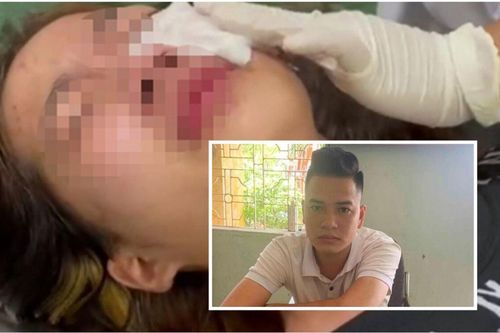 Lộ diện thanh niên xịt bình hơi cay vào mặt nữ sinh lớp 10 ở Hải Phòng sau cuộc trêu ghẹo