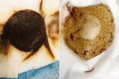 Vụ giun sán xuất hiện trong nước sinh hoạt tại khu đô thị Pháp Vân - Tứ Hiệp: Chờ kết quả mẫu nước để xác định nguyên nhân