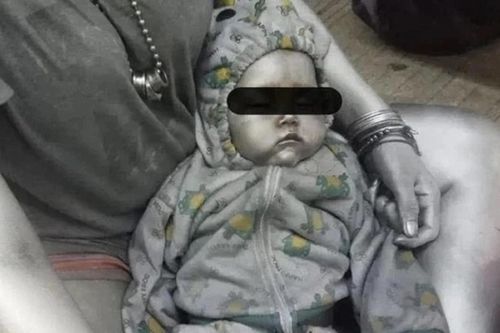 Mạng xã hội lan truyền ảnh em bé bị xịt sơn đầy người, cảnh sát bắt người mẹ
