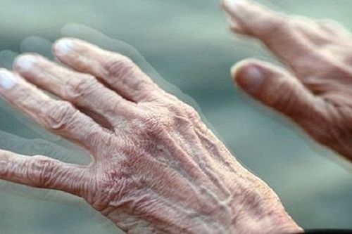 Thuốc nhỏ mũi có triển vọng làm chậm bệnh Parkinson
