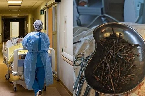 Choáng: Người đàn ông nuốt 1kg đinh vít vào bụng!