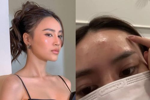 Ninh Dương Lan Ngọc lộ mặt chi chít mụn, không dám khoe cận nhan sắc trước ống kính