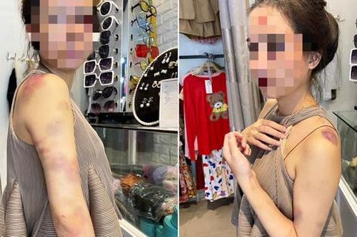 Vụ người vợ bị chồng đánh đập dã man ở Yên Bái: Hội LHPN tỉnh đề nghị xử lý nghiêm
