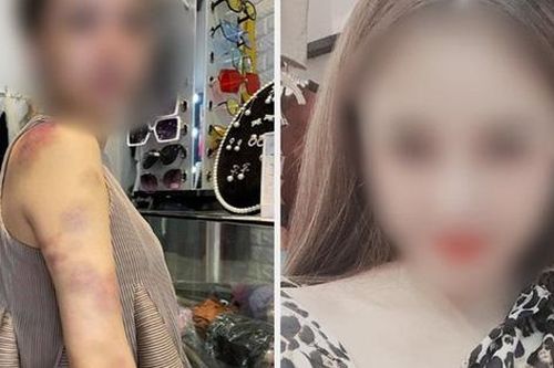 Người chồng bị vợ tố bạo hành ở Yên Bái: 'Đúng là tôi có đánh vợ nhưng không nhốt'