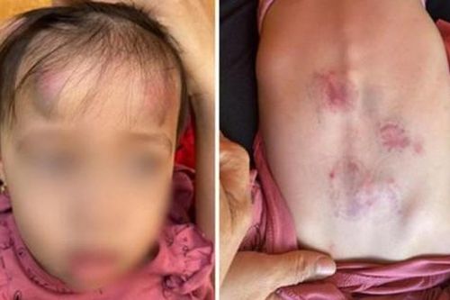 Trẻ 3 tuổi hung hăng đánh bạn do học trên tivi, điện thoại?