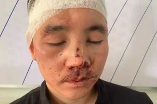 Hai phụ xe khách bị hành hung