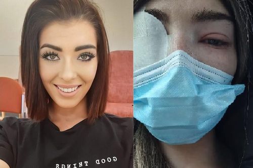Cô gái Anh suýt bị mù vì nối mi