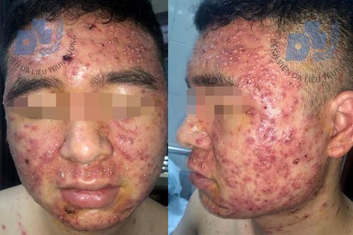 Quảng cáo hàng giả, hậu quả nhãn tiền