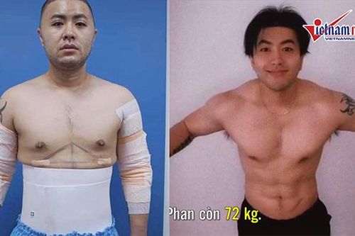 Akira Phan 'lột xác' ngoạn mục sau phẫu thuật 6 múi và giảm 13 kg