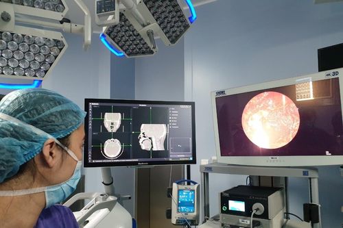 Phẫu thuật thành công cho bệnh nhân u nền vùng sọ xâm lấn phức tạp