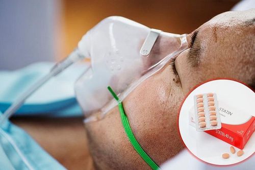 Nghiên cứu cho thấy thuốc statin không ngăn ngừa COVID-19 nghiêm trọng