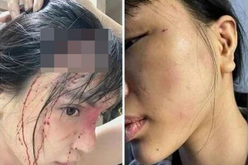 Công an điều tra vụ siêu mẫu Khả Trang tố bị bạn trai hành hung