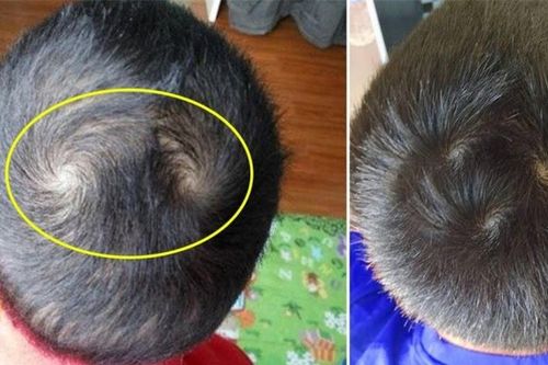 Nhìn vào xoáy tóc trên đầu, đoán được tương lai, vận mệnh của một người