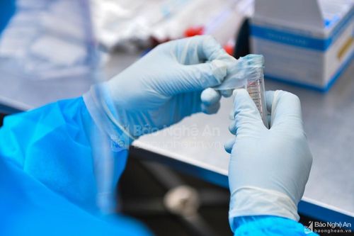 Chiều 20/12, Nghệ An ghi nhận 111 ca nhiễm Covid-19 mới, trong đó có 20 ca cộng đồng