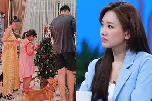 Hari Won, Thúy Diễm và nhiều sao Việt phẫn nộ vụ bé gái 8 tuổi bị 'dì ghẻ' bạo hành