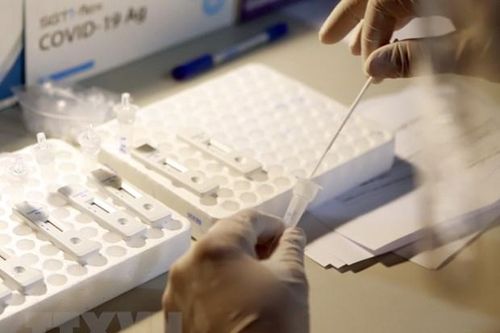 Thanh Hóa tăng cường công tác phòng, chống dịch COVID-19, kiểm soát biến chủng mới Omicron của SARS-CoV-2