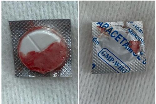 Bé trai 13 tuổi nuốt trọn viên thuốc còn nguyên vỏ