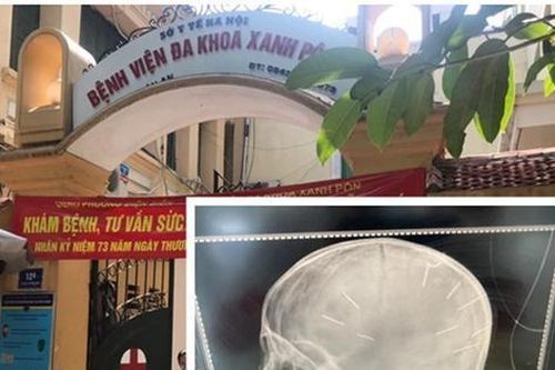 Gia đình người tình của mẹ bé gái bị ghim 9 chiếc đinh trong đầu nói gì?