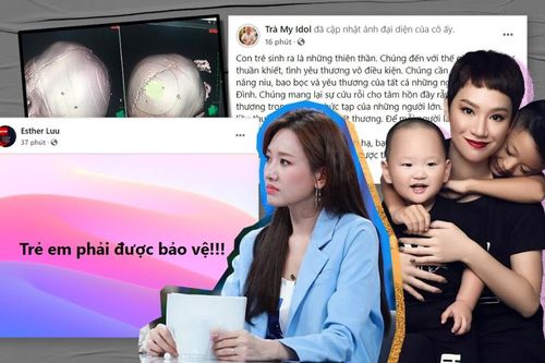 Vụ bé gái 3 tuổi bị đóng 9 cây đinh vào đầu: Hari Won và nhiều sao Việt lên tiếng bức xúc