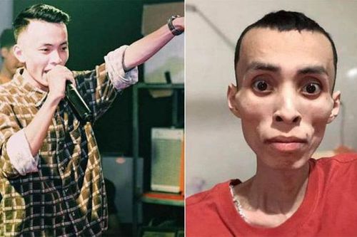 Nam rapper qua đời vì ung thư ở tuổi 27, bác sĩ chỉ cách phòng tránh căn bệnh nguy hiểm