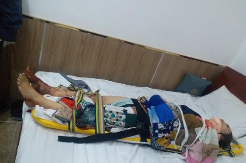 TP Hồ Chí Minh: Thang máy khách sạn rơi, một phụ nữ bị thương nặng