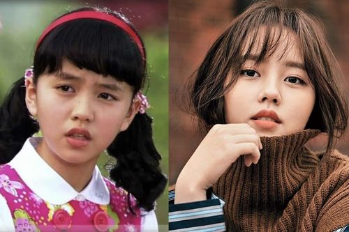 Bất ngờ với 5 màn 'dậy thì thành công' của các mỹ nữ hàng đầu xứ Hàn