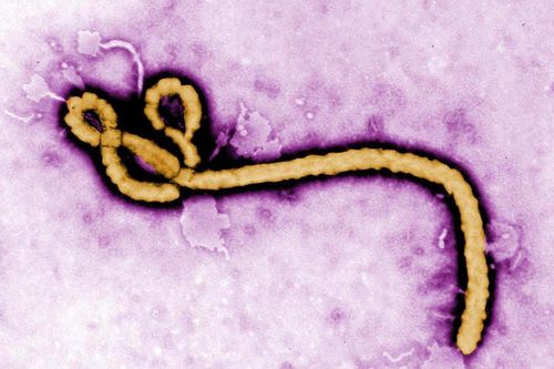 Phát hiện mới về loại virus khiến 25-90% người nhiễm bệnh tử vong