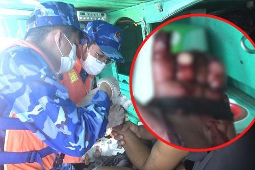 Ngư dân gặp nạn, đứt lìa 4 ngón tay khi đánh bắt trên biển