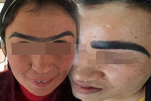 Điêu khắc chân mày: Con dao hai lưỡi có thể làm vẻ đẹp của bạn tan biến