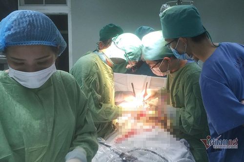 Trắng đêm phẫu thuật rút xà beng xuyên qua ngực người đàn ông ở Nghệ An