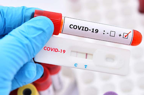 Vì sao có kết quả âm tính giả, dương tính giả khi test nhanh COVID-19?