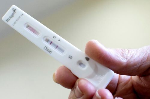 Vạch kit test COVID-19 lúc đậm lúc mờ thể hiện điều gì?