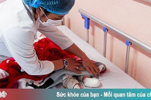 Xông mũi họng để phòng COVID-19, bé trai 6 tháng tuổi bị bỏng, nhiễm trùng máu