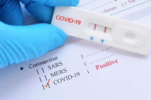 Các triệu chứng của COVID-19 rõ ràng nhưng vì sao test nhanh vẫn âm tính?