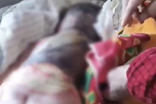 Bé trai bỏng toàn thân vì bị mẹ thả vào lửa, hành vi 'táng tận lương tâm' của ông bố còn ghê sợ hơn